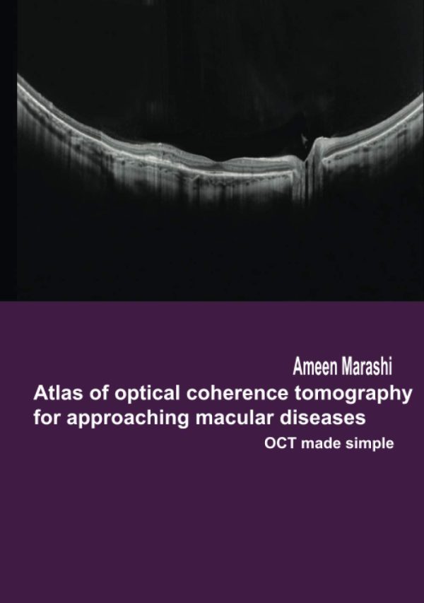 Atlas of optical coherence tomography for approaching macular diseases: OCT made simple (Atlas of OCT for approaching macular diseases)