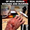Special Effects Guide Of Real Human Wounds and Injuries: Special Effects Guide Of Real Human Wounds and Injuries
