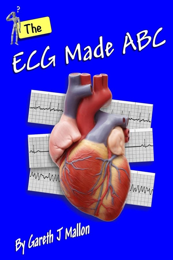 The ECG Made ABC